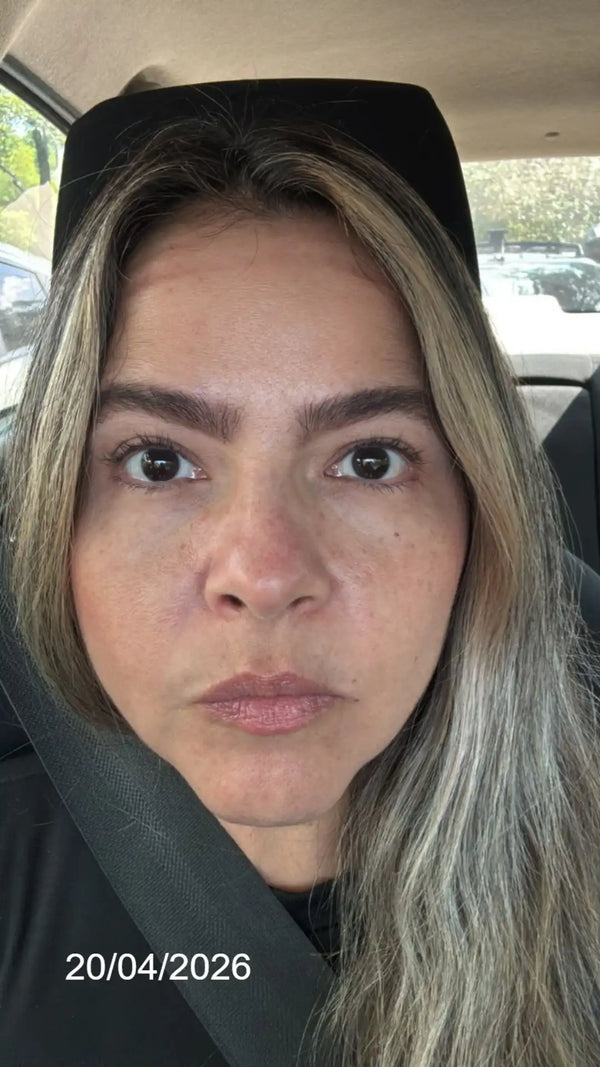 Antes